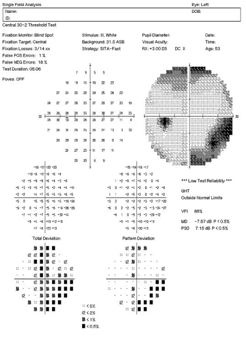 D33.3 Benign Neoplasm of Cranial Nerves - Decision-Maker PLUS