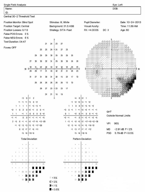 Narrow-Angle Glaucoma - Decision-Maker PLUS