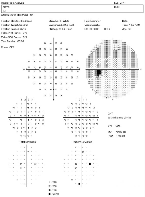 H40.011-023 Open-Angle Glaucoma Suspect, Low Risk - Decision-Maker PLUS