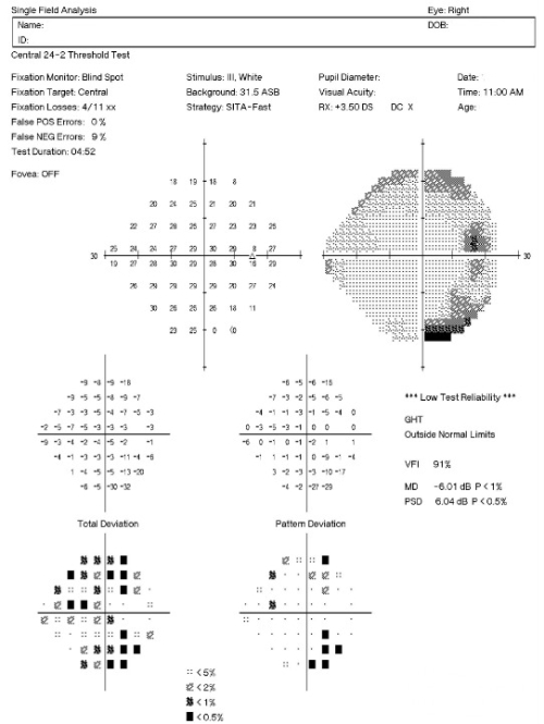 Diabetic Retinopathy Without Macular Edema - Decision-Maker PLUS