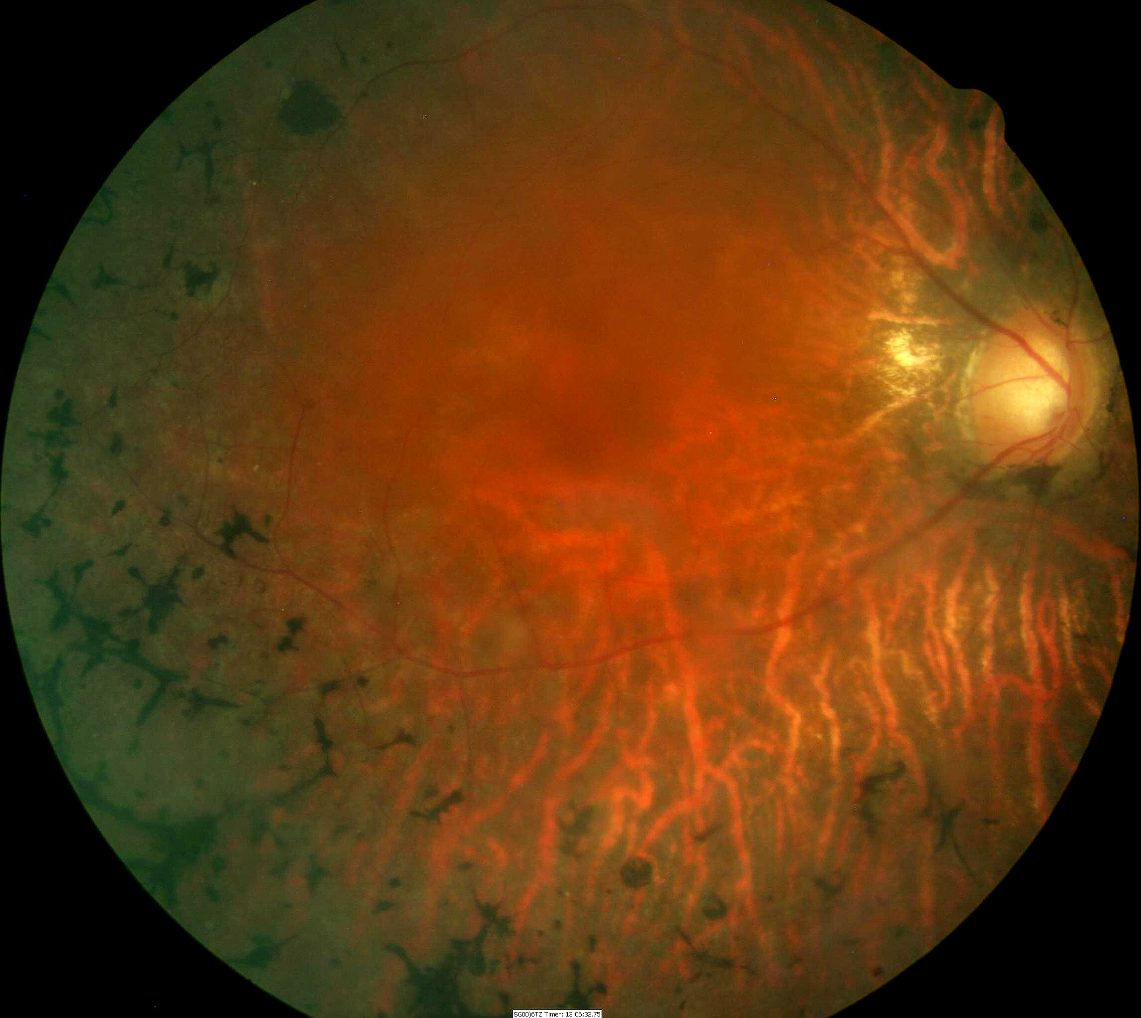 Crystal retinal
